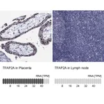 Atlas Antibodies Anti-TFAP2A Antibody