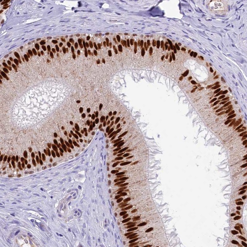 Atlas Antibodies Anti-TFAP2B Antibody