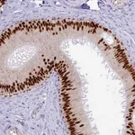 Atlas Antibodies Anti-TFAP2B Antibody