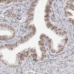Atlas Antibodies Anti-TFAP4 Antibody