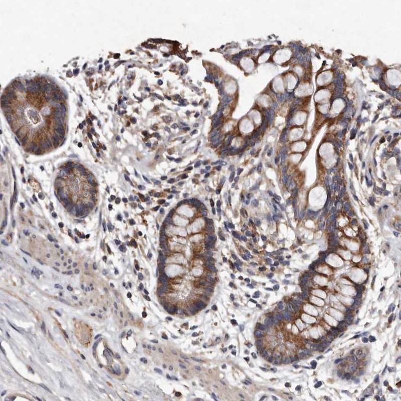 Atlas Antibodies Anti-TFB1M Antibody