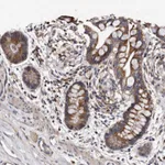 Atlas Antibodies Anti-TFB1M Antibody