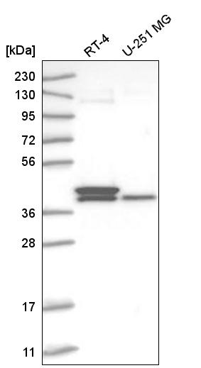 Atlas Antibodies Anti-TFB2M Antibody