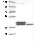 Atlas Antibodies Anti-TFB2M Antibody