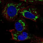 Atlas Antibodies Anti-TFB2M Antibody