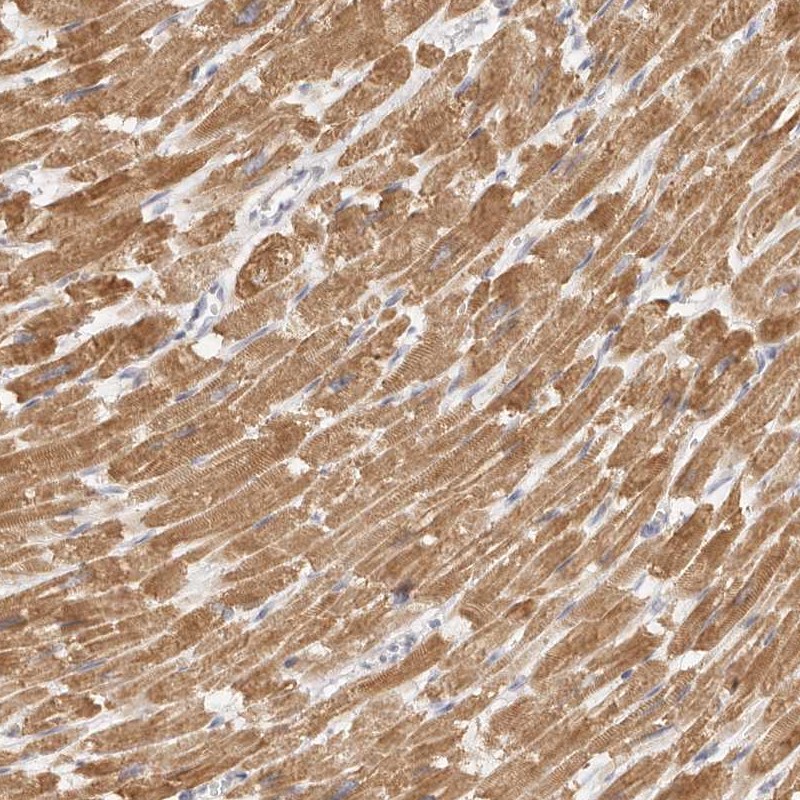 Atlas Antibodies Anti-TFB2M Antibody
