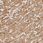 Atlas Antibodies Anti-TFB2M Antibody