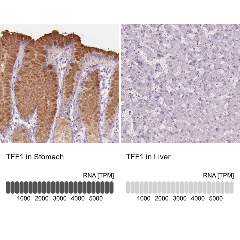 Atlas Antibodies Anti-TFF1 Antibody