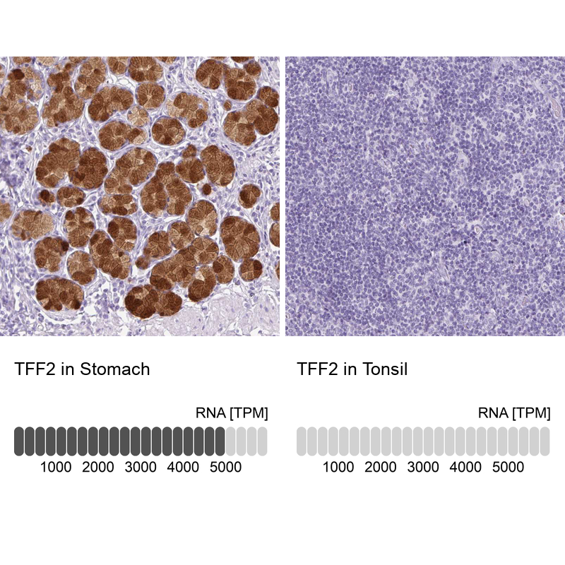 Atlas Antibodies Anti-TFF2 Antibody