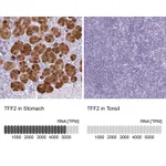 Atlas Antibodies Anti-TFF2 Antibody