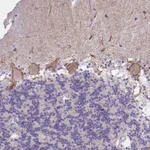 Merck Anti-KCNMA1 antibody produced in rabbit
