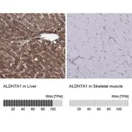 Merck Anti-ALDH7A1 antibody produced in rabbit