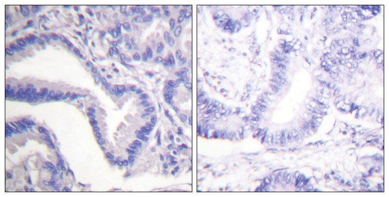 Merck Anti-CASP7 (Cleaved-Asp198) antibody produced in rabbit