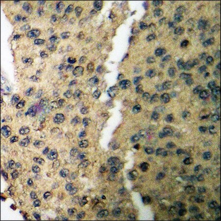 Merck Anti-phospho-CaMK1-alpha (pThr177) antibody produced in rabbit