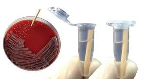 Merck smartPick Wooden inoculation picks