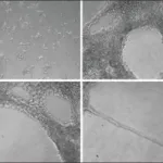 Merck ECM Gel from Engelbreth-Holm-Swarm murine sarcoma