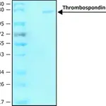 Merck Thrombospondin-1 human