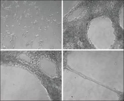 Merck Collagen from Engelbreth-Holm-Swarm murine sarcoma basement membrane