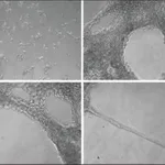 Merck Collagen from Engelbreth-Holm-Swarm murine sarcoma basement membrane