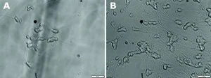 Merck Brain-derived neurotrophic factor human