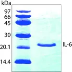 Merck Interleukin-6 human
