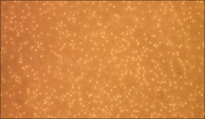 Merck Human Peripheral Blood Monocytes: HPBM