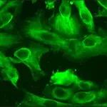 Merck Human Renal Proximal Tubular Epithelial Cells: HRPTEpC, fetal