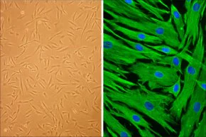 Merck Hair Follicle Dermal Papilla Cells: HFDPC, adult