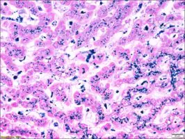 Merck Iron TISSUE-TROL Control Slides