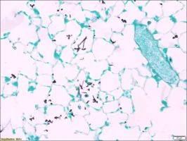 Merck Fungi TISSUE-TROL Control Slides