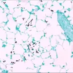 Merck Fungi TISSUE-TROL Control Slides