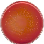 Merck MacConkey Agar