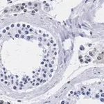 Merck Anti-TFE3 Antibody, clone 1G5 ZooMAb Rabbit Monoclonal