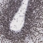 Merck Anti-LMX-1 Antibody, clone 4L12, ZooMAb Rabbit Monoclonal