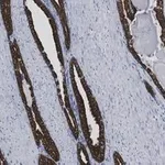 Merck Anti-Cytokeratin-8 Antibody, clone 2D17 ZooMAb Rabbit Monoclonal