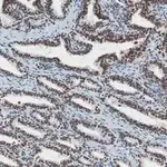 Merck Anti-ATRX Antibody, clone 2A12, ZooMAb Rabbit Monoclonal