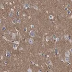 Merck Anti-CD56 Antibody, clone 3F5 ZooMAb Rabbit Monoclonal