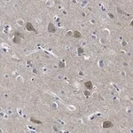 Merck Anti-PSD-95 Antibody, clone 2B20 ZooMAb Rabbit Monoclonal