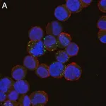 Merck Anti-ULBP1 Antibody, clone 6B17 ZooMAb Rabbit Monoclonal