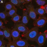 Merck Anti-Twist1 Antibody, clone 4L15 ZooMAb Rabbit Monoclonal