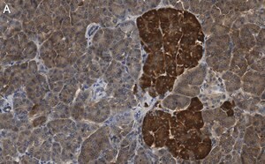 Merck Anti-CNKSR1 Antibody, clone 4B7 ZooMAb Rabbit Monoclonal
