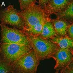 Merck Anti-MCU Antibody, clone 3N3 ZooMAb Rabbit Monoclonal