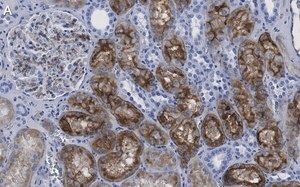 Merck Anti-Aquaporin-1 Antibody, clone 2I7 ZooMAb Rabbit Monoclonal