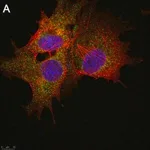 Merck Anti-SLC19A1 Antibody, clone 2E11 ZooMAb Rabbit Monoclonal