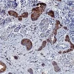 Merck Anti-Phospho-ACC1-(Ser79) Antibody, clone 1E11 ZooMAb Rabbit Monoclonal