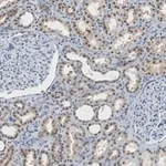 Merck Anti-CARM1 Antibody, clone 2H11 ZooMAb Rabbit Monoclonal
