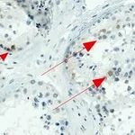 Merck Anti-NY-ESO-1 Antibody, clone 1J11 ZooMAb Rabbit Monoclonal