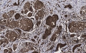 Merck Anti-phospho-HDAC4 (S246) Antibody, clone 1I14 ZooMAb Rabbit Monoclonal