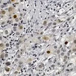 Merck Anti-Phospho-AKT1-(Ser473) Antibody, clone 1O14 ZooMAb Rabbit Monoclonal