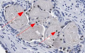 Merck Anti-Phospho-HDAC7-(Ser486) Antibody, clone 3O11 ZooMAb Rabbit Monoclonal